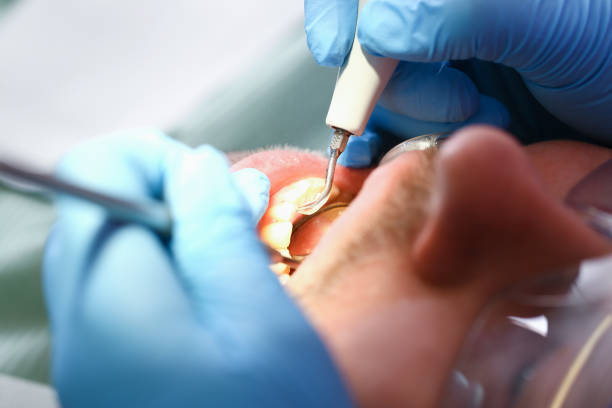 Best Emergency Dental Care for Abscessed Tooth in Harwich Center, MA