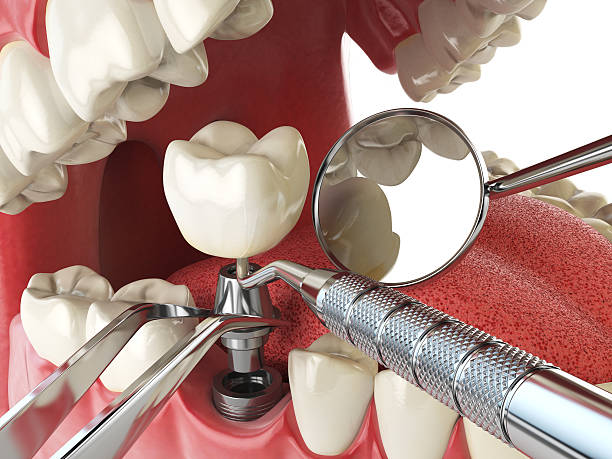 Best Emergency Dentist for Knocked-Out Tooth in Harwich Center, MA